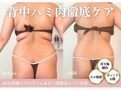ハナ チュチュ(Hana chuchu)の写真