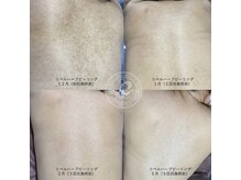 サロン バイオビオ(SALON BioBio)/