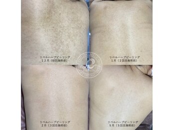 サロン バイオビオ(SALON BioBio)/