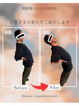 東船橋スタンス整体院の写真/ 【あなたの不調、原因は骨格にあり！】骨格診断×姿勢矯正で根本改善！理想のボディラインと健康な体へ