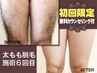 【初回限定/メンズ脱毛】脚全体メンズ脱毛◆￥3,980♪ 女性もOK