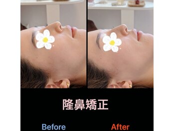 美容矯正サロン レレポノ(LELEPONO)/