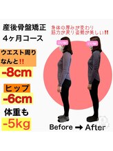 リノア(Linoa)/産後ママさんビフォーアフター