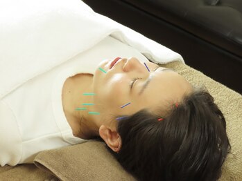 中目黒ゆう鍼灸 整骨院の写真/歴20年の美容鍼で血行促進し、たるみ改善、リフトアップ、小顔効果◎キレイ×健康のサポート！