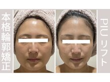 ピュウリリアーナ(PIU LILIANA)の雰囲気(岡山初導入最新マシン×プロの技術で本気の輪郭矯正!!)