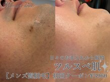 モナートドゥ(Monartdeux)の雰囲気（最新のハイパワー脱毛器を採用！全身or各パーツ脱毛も可能です◎）