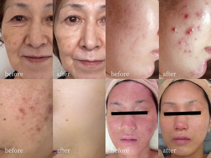 アーネスト 大阪心斎橋店(EARNEST)の写真