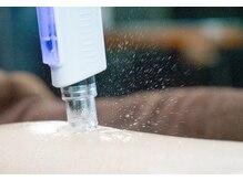 ラ フルール(La Fleur)/エアバリ