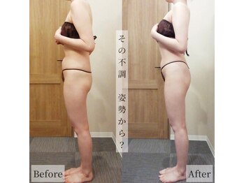 レイプラス 仙台店(RAY PLUS)/◆ビフォーアフター例のご紹介◆