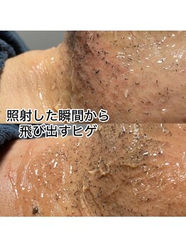 なごみや/照射した瞬間から飛び出すヒゲ