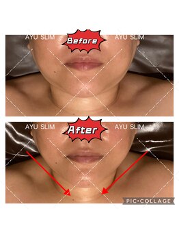 アユスリム(AYU SLIM)/一回でも変化できるの充実小顔