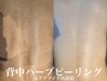 NEW★【剥離あり】背中全体 ハーブピーリング　アフターケア付き2回来店