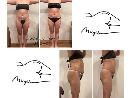 ミ ライト(m light)の写真