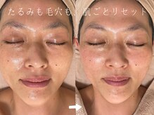 サロンドシエル カスガイ(Salon de Ciel kasugai)/たるみも毛穴も、肌ごとリセット