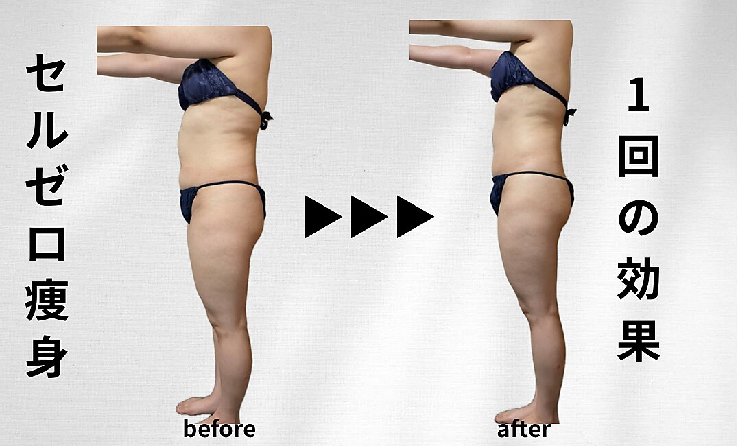 ボディ・フェイスケア ELENA エレナ(Elena)｜ホットペッパービューティー