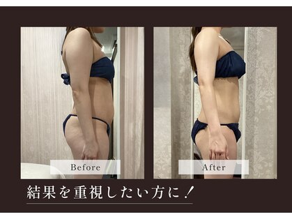 アディッシモ(addissimo)の写真