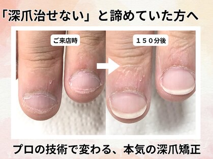 エルナの写真