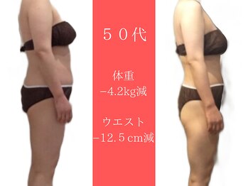 ムーン 高崎店(MOON)/セルゼロ痩身