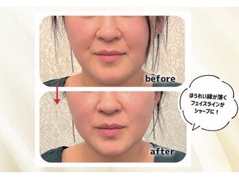 ラ フルール(La Fleur)/エアバリ