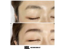 アート(ART)/ハリウッドブロウリフト