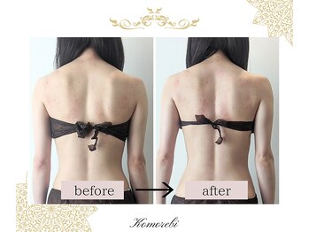 コモレビ(Komorebi)/