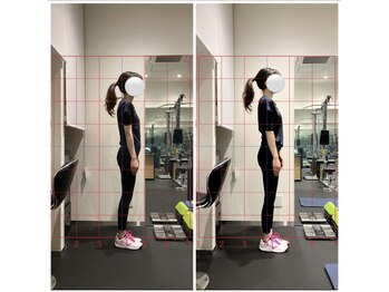 W2 馬車道/姿勢改善ビフォーアフター♪