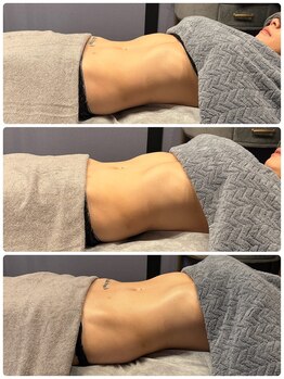 ロザリー(ROSALY)/腸もみＢ＆Ｆ