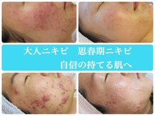 京都美顔