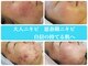 京都美顔の写真