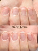 マリーロール 淀屋橋本店(Marie Laure)/自爪育成/深爪矯正/ネイルケア