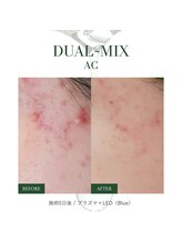 ホワイトセージ(White Sage)/ビフォーアフター