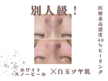 エステティック レイビス 池袋店(RAYVIS)/白玉スノーピール