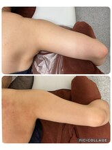 エスビーエス オキナワ(SBS OKINAWA)/