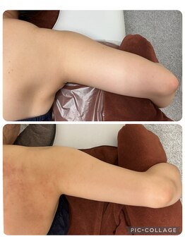 エスビーエス オキナワ(SBS OKINAWA)/