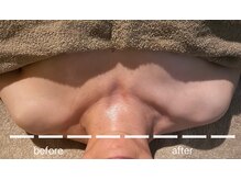 オリス(Oris)/スロータスフェイシャル