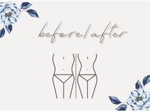 痩身ハイパーナイフメンズ【salon blue rose】新栄町/千種/痩身/ダイエット/脂肪燃焼/痩身ハイパーナイフメンズ