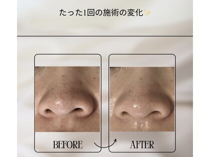 リュミエール(Lumiere)の写真
