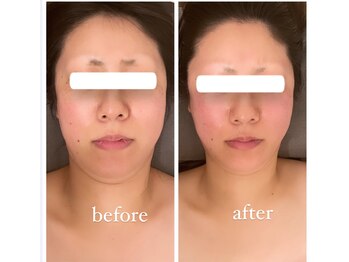 ジーニー(Genie)/結婚式までに！！！