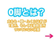 タスク整体院/O脚とは？