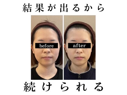 キュープ 富山店(Qpu)の写真