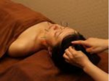 ハリラックス(HA:Ri/LAX)/【美容鍼灸の様子】