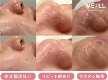 ウィール 栄 矢場町店(WE:LL)