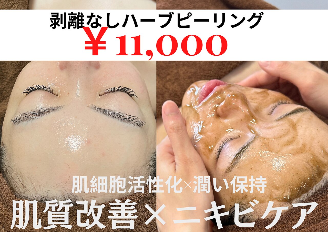 サロン専売品☆ハーブピーリング ダウンタイムなし！剥離なし！肌質改善 小分け販売 サロン専売品☆ハーブピーリング ダウンタイムなし！剥離なし！肌質