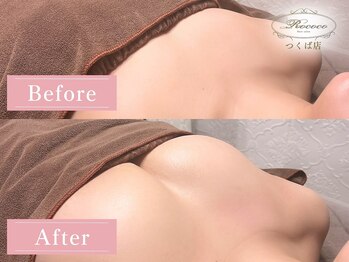 ロココ つくば店(Rococo)/BEFORE/AFTER