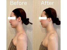 サロン ド シャルール/横顔美人