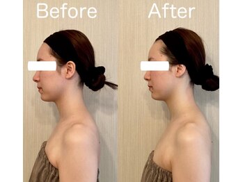 サロン ド シャルール/横顔美人