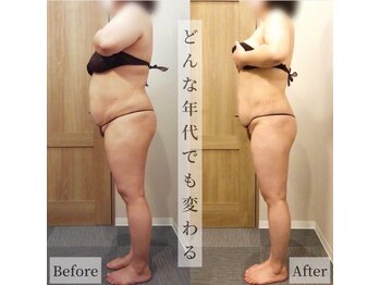 レイプラス 仙台店(RAY PLUS)/◆ビフォーアフター例のご紹介◆