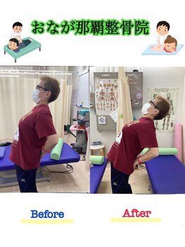 おなが浦添当山整骨院/腰痛施術