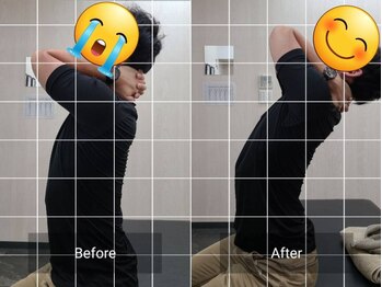 ナオル整体 西川口院(NAORU整体)/お客様のbefore/after　上体反り