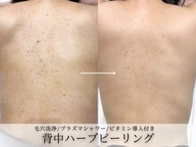 フェイシャルヴィム(FACIAL VIM)